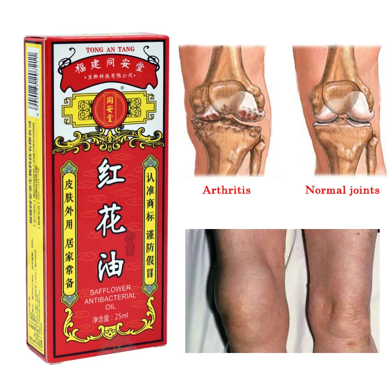 25ml tradicinės Kinų medicinos dygminų aliejus gali gydyti raumenų įtampą ir skausmą
