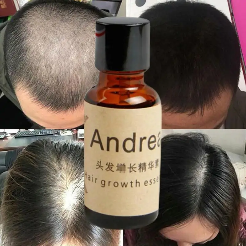 20ml Andrea Greitą Plaukų Augimą Natūralių Organinių Atauga Gydymas Dropshipping