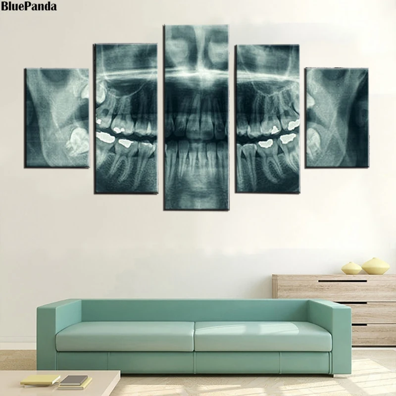 Dantų rentgeno spinduliuotės HD Drobės tapyti Aliejumi Spausdinti Plakato 5 vnt Sienos Meno Šiuolaikinės Nuotraukos Miegamojo, Biuro, Namų Dekoro