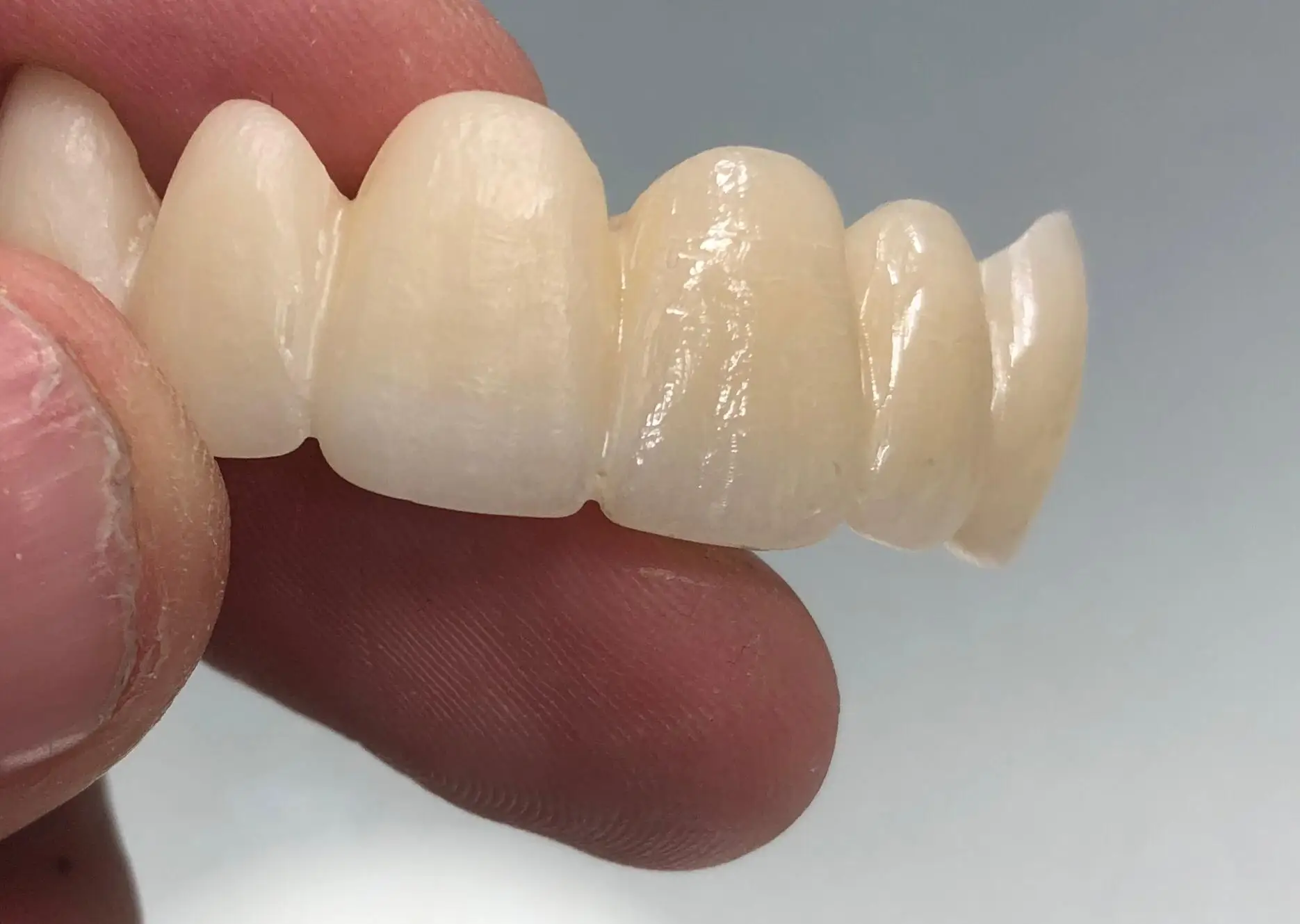 ST+ML amann 98-71-25mm super didelis vaiskumą daugiasluoksnės cirkonis blokuoti Amann Girrbach A1-D4, cirkonio dantų